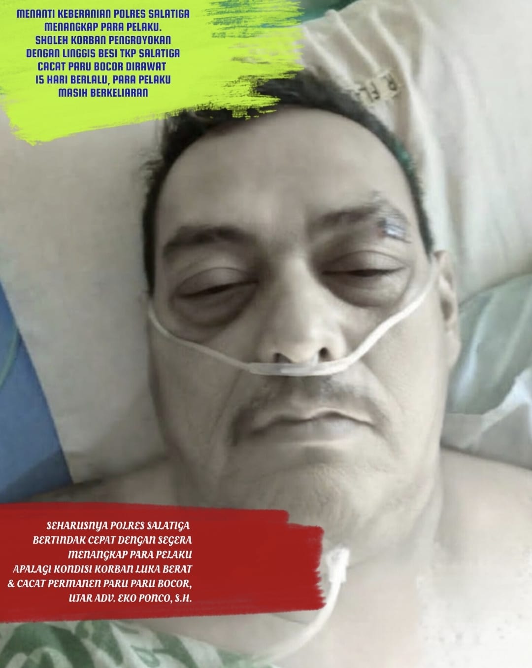 Sholeh Korban Pengroyokan Dgn Linggis Besi Kondisi Memburuk & Cacat Paru Bocor, Polres Salatiga Belum Menangkap Pelaku². 15 hari berlalu.
